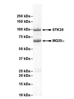 Eurofins DiscoverX STK39 Protein, Active 10 &mu;g | Buy Online | Eurofins DiscoverX | Fisher Scientific